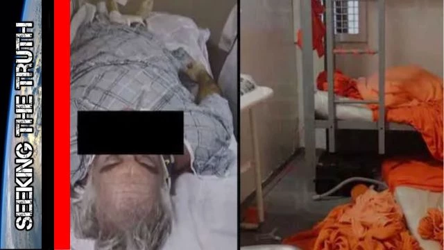 Epstein Autopsy Photos on 60 Minutes Suggest MURDER (1)